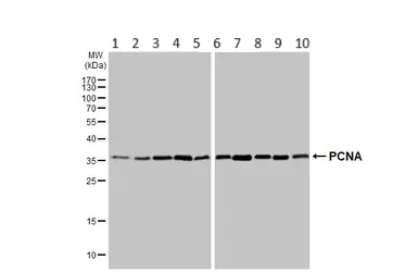 Western blot - Anti-PCNA antibody [HL1965] (AB308212)