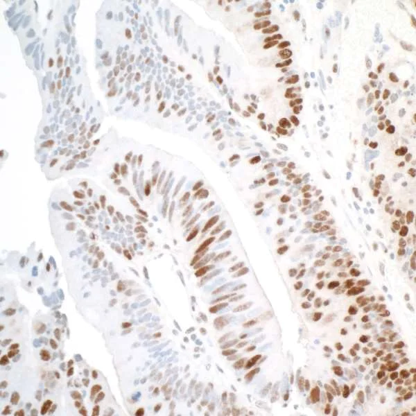Immunohistochemistry (Formalin/PFA-fixed paraffin-embedded sections) - Anti-PCNA antibody [PC10] (AB265585)