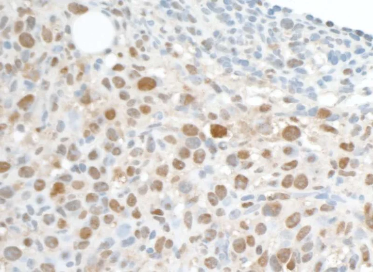Immunohistochemistry (Formalin/PFA-fixed paraffin-embedded sections) - Anti-PCNA antibody [PC10] (AB265585)
