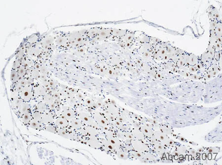 Immunohistochemistry (Formalin/PFA-fixed paraffin-embedded sections) - Anti-PCNA antibody [PC10] (AB29)