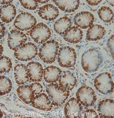 Immunohistochemistry (Formalin/PFA-fixed paraffin-embedded sections) - Anti-PCNA antibody [PC10] (AB29)