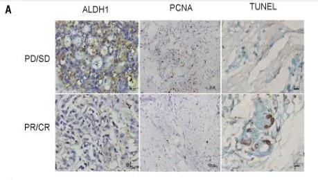 Immunohistochemistry (Formalin/PFA-fixed paraffin-embedded sections) - Anti-PCNA antibody [PC10] (AB29)