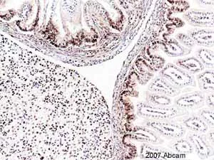 Immunohistochemistry (Formalin/PFA-fixed paraffin-embedded sections) - Anti-PCNA antibody [PC10] (AB29)
