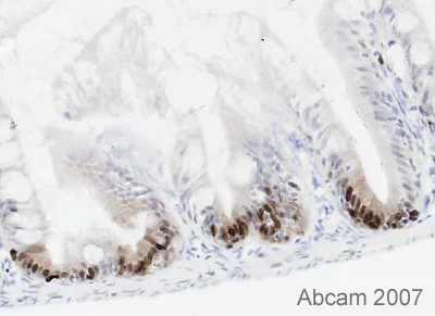 Immunohistochemistry (Formalin/PFA-fixed paraffin-embedded sections) - Anti-PCNA antibody [PC10] (AB29)