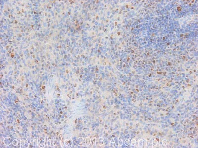 Immunohistochemistry (Formalin/PFA-fixed paraffin-embedded sections) - Anti-PCNA antibody [PC10] (AB29)