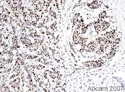 Immunohistochemistry (Formalin/PFA-fixed paraffin-embedded sections) - Anti-PCNA antibody [PC10] (AB29)