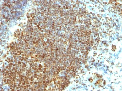 Immunohistochemistry (Formalin/PFA-fixed paraffin-embedded sections) - Anti-PCNA antibody [PCNA/694] (AB220208)