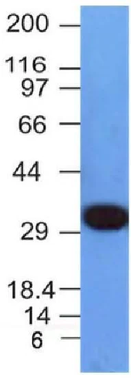 Western blot - Anti-PCNA antibody [PCNA/694] (AB220208)