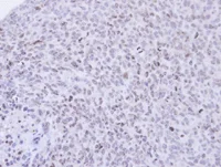 Immunohistochemistry (Formalin/PFA-fixed paraffin-embedded sections) - Anti-PCNP antibody (AB97909)