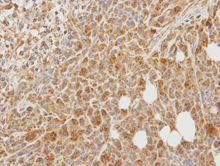 Immunohistochemistry (Formalin/PFA-fixed paraffin-embedded sections) - Anti-PCOLCE antibody (AB154261), expandable thumbnail