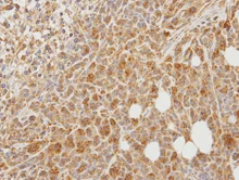 Immunohistochemistry (Formalin/PFA-fixed paraffin-embedded sections) - Anti-PCOLCE antibody (AB154261)