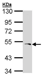 Western blot - Anti-PCOLCE antibody (AB154261)