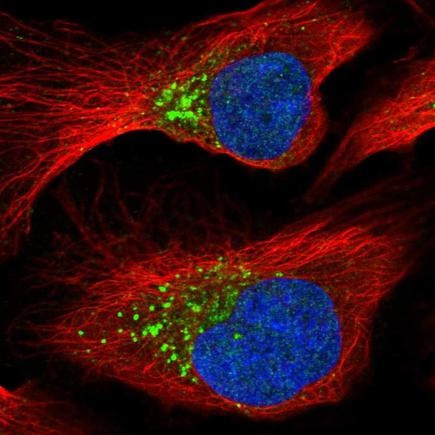 Immunocytochemistry/ Immunofluorescence - Anti-PCOLCE antibody (AB220040)