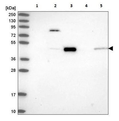 Western blot - Anti-PCOLCE antibody (AB220040)