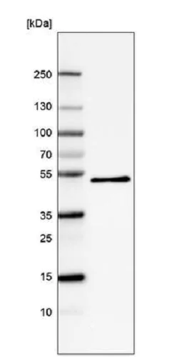 Western blot - Anti-PCOLCE antibody [CL6567] (AB243024)