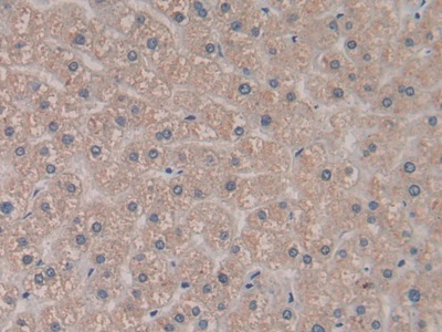 Immunohistochemistry (Formalin/PFA-fixed paraffin-embedded sections) - Anti-PCPE-2 antibody (AB232721), expandable thumbnail