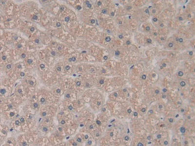 Immunohistochemistry (Formalin/PFA-fixed paraffin-embedded sections) - Anti-PCPE-2 antibody (AB232721)