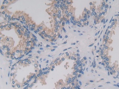 Immunohistochemistry (Formalin/PFA-fixed paraffin-embedded sections) - Anti-PCPE-2 antibody (ab232721), expandable thumbnail