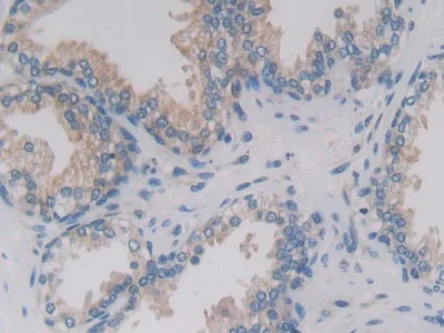 Immunohistochemistry (Formalin/PFA-fixed paraffin-embedded sections) - Anti-PCPE-2 antibody (AB232721)