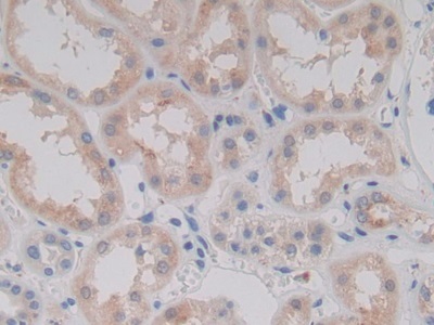 Immunohistochemistry (Formalin/PFA-fixed paraffin-embedded sections) - Anti-PCPE-2 antibody (AB232721), expandable thumbnail