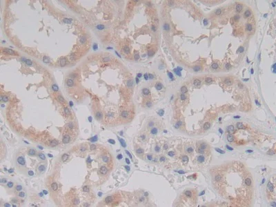 Immunohistochemistry (Formalin/PFA-fixed paraffin-embedded sections) - Anti-PCPE-2 antibody (AB232721)