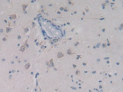 Immunohistochemistry (Formalin/PFA-fixed paraffin-embedded sections) - Anti-PCPE-2 antibody (AB232721)