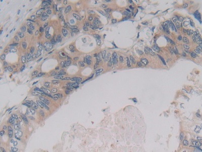 Immunohistochemistry (Formalin/PFA-fixed paraffin-embedded sections) - Anti-PCPE-2 antibody (ab232721), expandable thumbnail