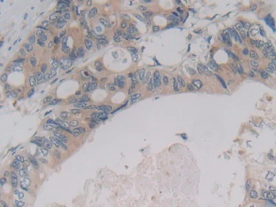 Immunohistochemistry (Formalin/PFA-fixed paraffin-embedded sections) - Anti-PCPE-2 antibody (AB232721)