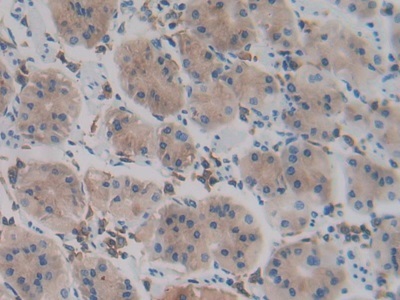 Immunohistochemistry (Formalin/PFA-fixed paraffin-embedded sections) - Anti-PCPE-2 antibody (AB232721), expandable thumbnail