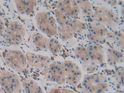 Immunohistochemistry (Formalin/PFA-fixed paraffin-embedded sections) - Anti-PCPE-2 antibody (AB232721)