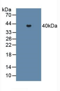 Western blot - Anti-PCPE-2 antibody (AB232721), expandable thumbnail