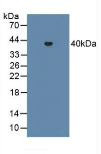 Western blot - Anti-PCPE-2 antibody (AB232721)