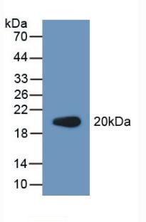 Western blot - Anti-PCPE-2 antibody (AB232721), expandable thumbnail