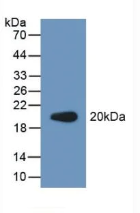 Western blot - Anti-PCPE-2 antibody (AB232721)
