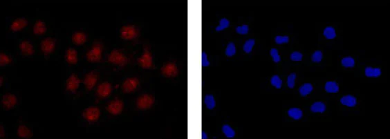 Immunocytochemistry/ Immunofluorescence - Anti-PCQAP / MED15 antibody [EPR13309] (AB181158)