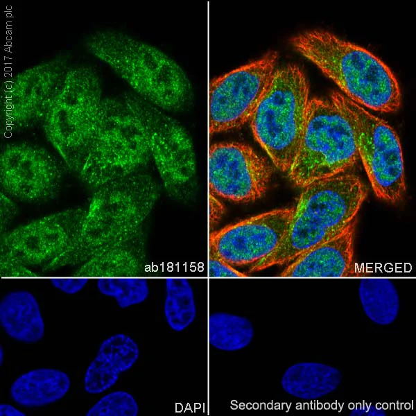 Immunocytochemistry/ Immunofluorescence - Anti-PCQAP / MED15 antibody [EPR13309] (AB181158)
