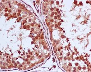 Immunohistochemistry (Formalin/PFA-fixed paraffin-embedded sections) - Anti-PCQAP / MED15 antibody [EPR13309] (AB181158)