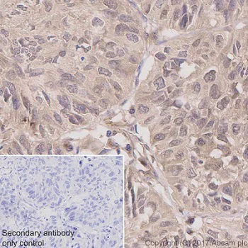 Immunohistochemistry (Formalin/PFA-fixed paraffin-embedded sections) - Anti-PCQAP / MED15 antibody [EPR13309] (AB181158)