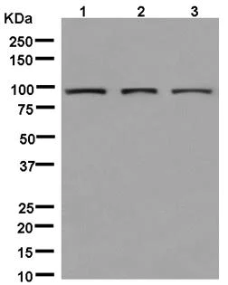 Western blot - Anti-PCQAP / MED15 antibody [EPR13309] (AB181158)