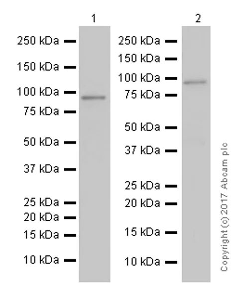 Western blot - Anti-PCQAP / MED15 antibody [EPR13309] (AB181158)
