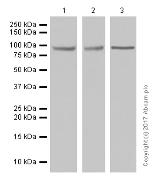 Western blot - Anti-PCQAP / MED15 antibody [EPR13309] (AB181158)