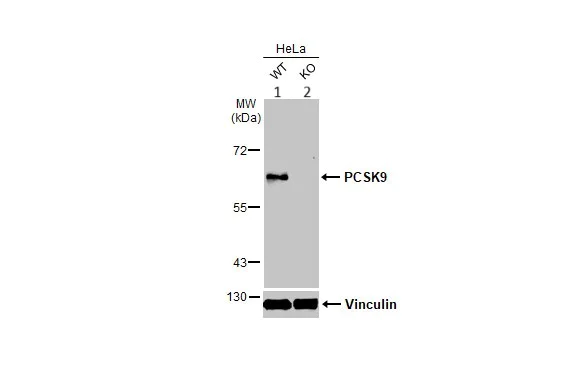 Western blot - Anti-PCSK9 antibody (AB272907)