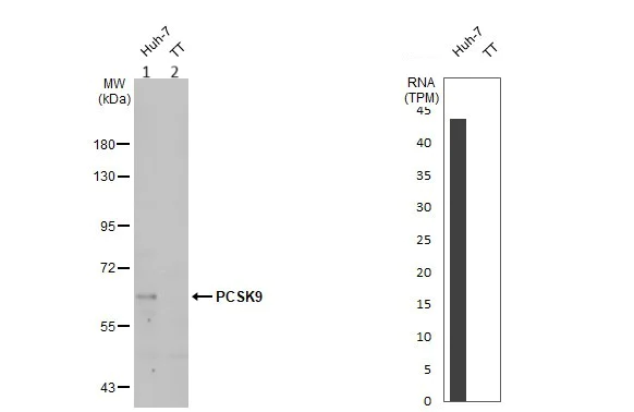 Western blot - Anti-PCSK9 antibody (AB272907)
