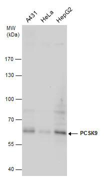 Western blot - Anti-PCSK9 antibody (AB272907)