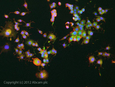 Immunocytochemistry/ Immunofluorescence - Anti-PCSK9 antibody (AB31762)