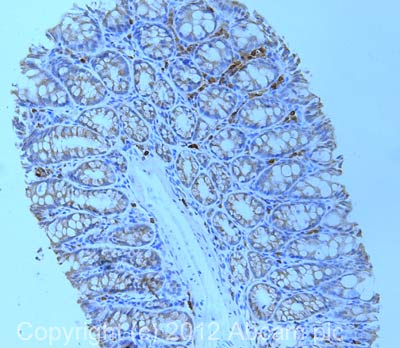 Immunohistochemistry (Formalin/PFA-fixed paraffin-embedded sections) - Anti-PCSK9 antibody (AB31762), expandable thumbnail