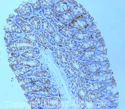 Immunohistochemistry (Formalin/PFA-fixed paraffin-embedded sections) - Anti-PCSK9 antibody (AB31762)