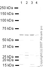 Western blot - Anti-PCSK9 antibody (AB31762), expandable thumbnail