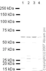 Western blot - Anti-PCSK9 antibody (AB31762)
