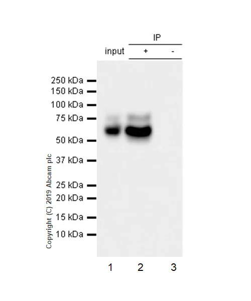 Immunoprecipitation - Anti-PCSK9 antibody [EPR17827-117] (AB185194)